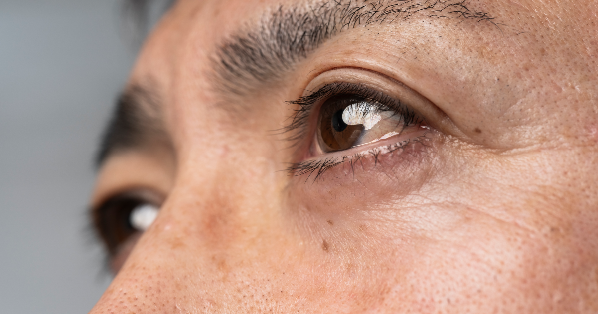 This company is developing an eye test to help detect Alzheimer's
