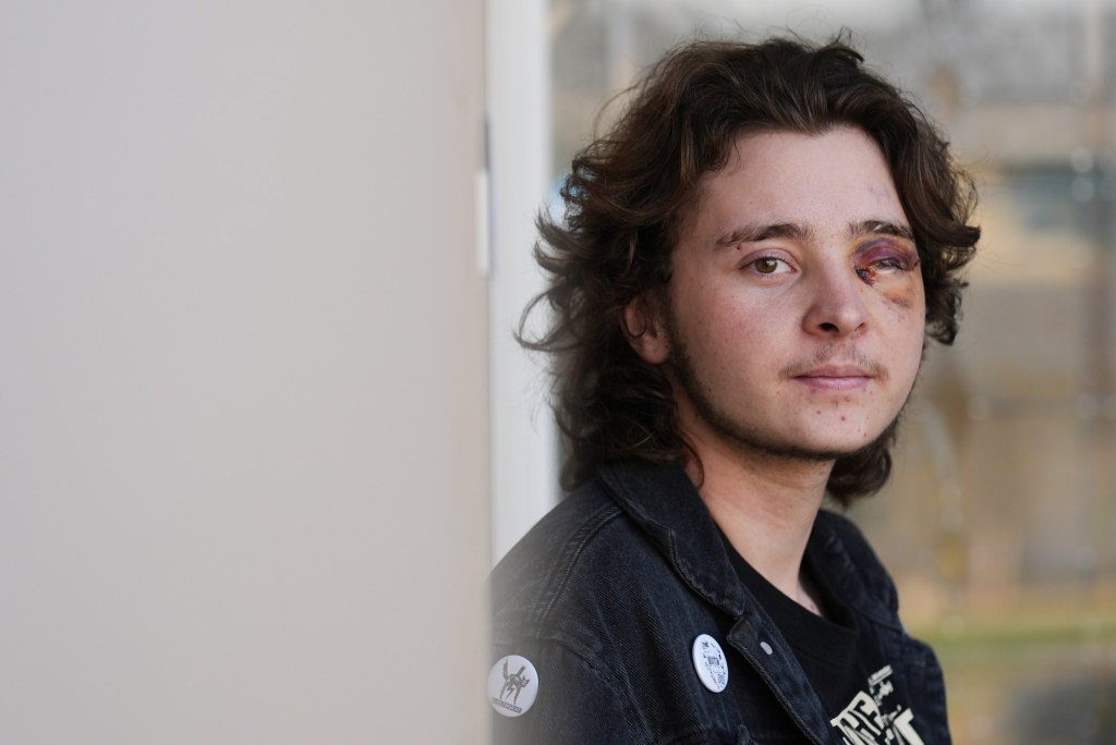 Demonstrator injured after federal agent fired projectile from close range during California protest
