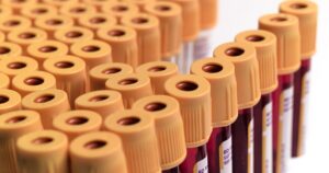 UA professor awarded $1.8M to develop targeted medicine that mimic red blood cells